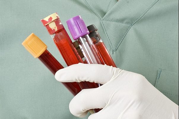 Samples of bodily fluids